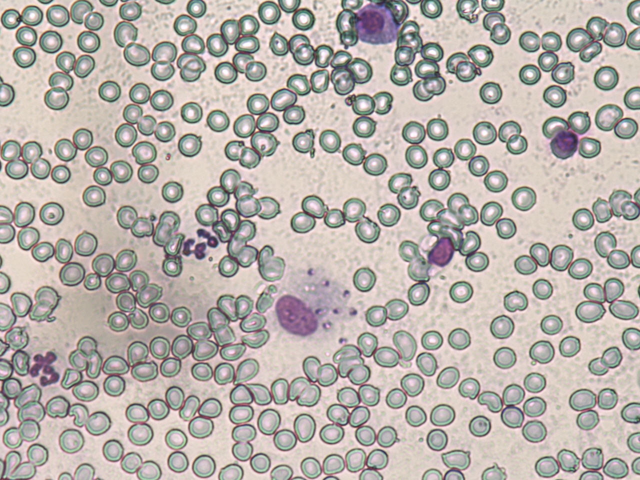 Amastigotes de Leishmania infantum